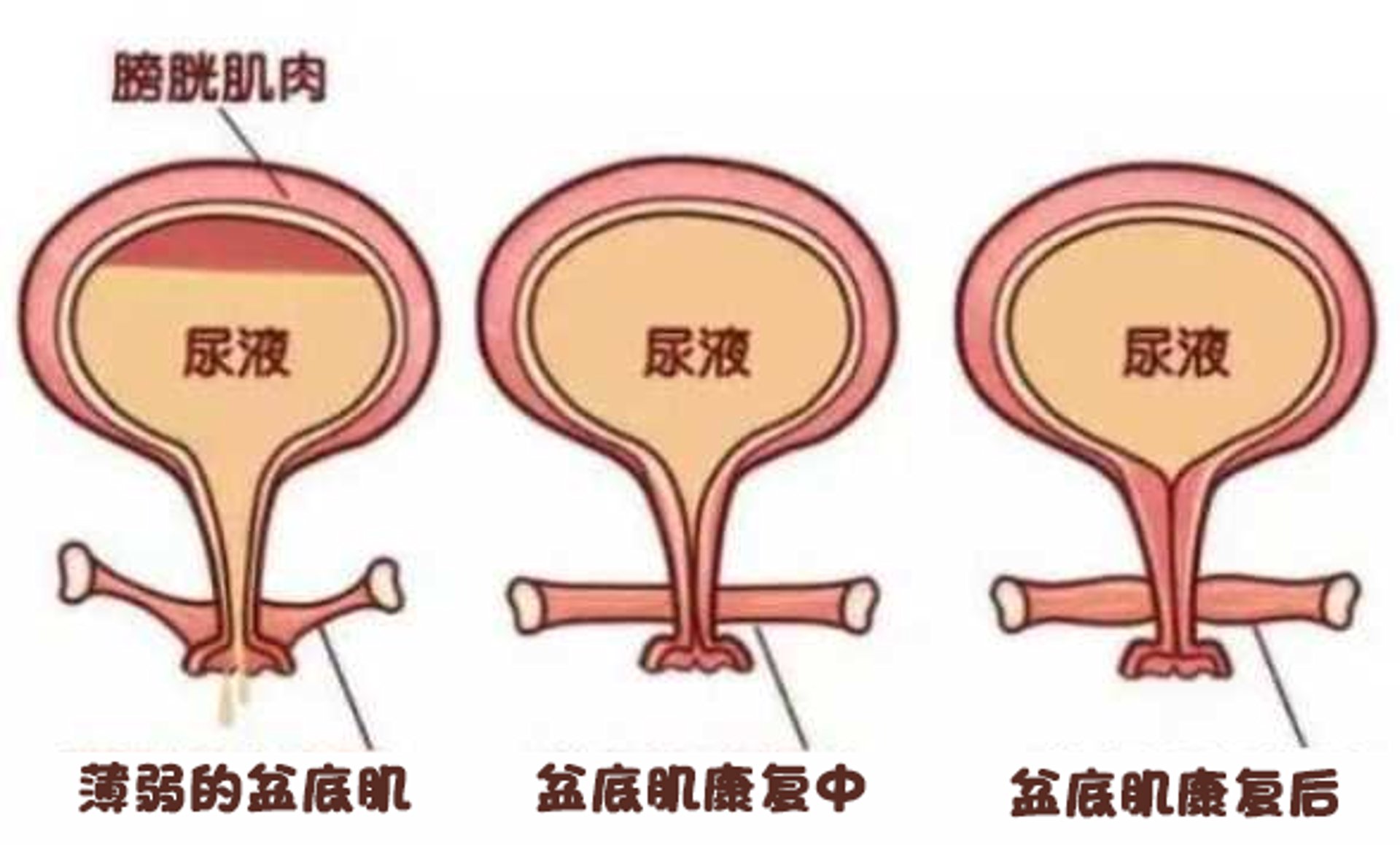 雪儿海蒂健康